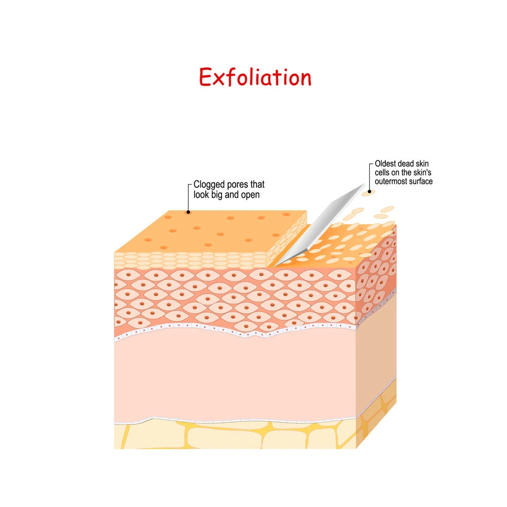 Exfoliation Peeling or Physically scrubbing
