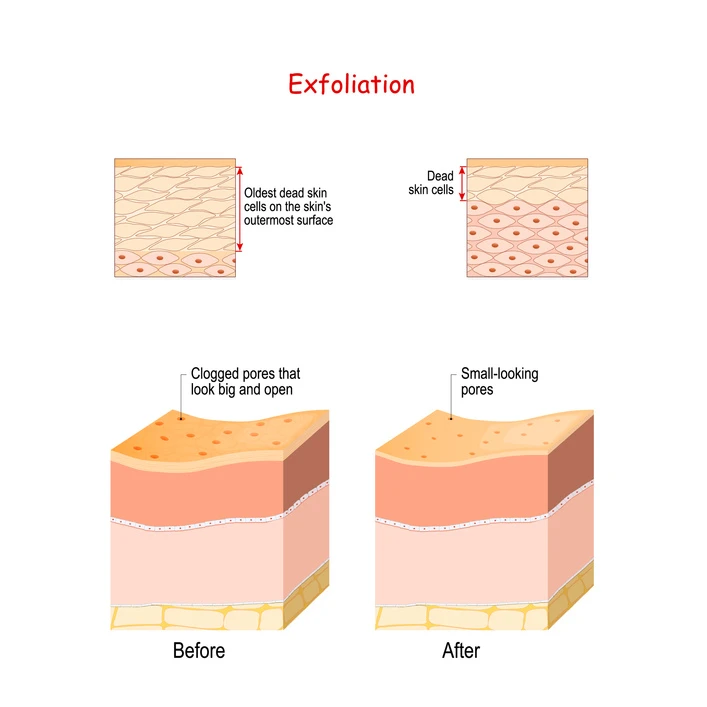 Skin layers before and after Exfoliation